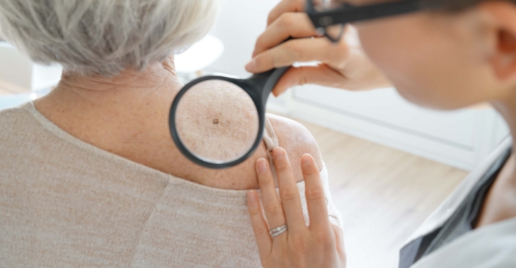 Skin Check