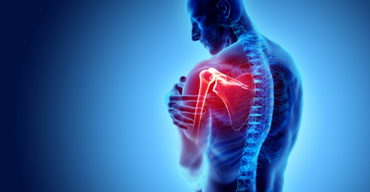 Shoulder Arthritis