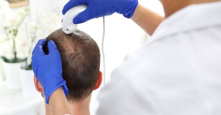 Hair Loss Treatment