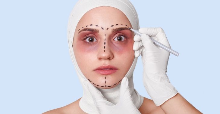 Facelift Recovery