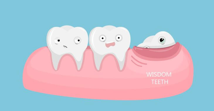 coming in wisdom tooth