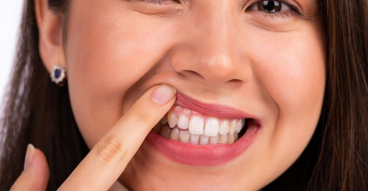 Woman checking her teeth for cavities.