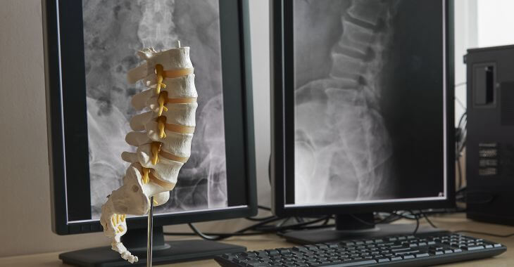 A model of a spine and spine x-rays on the desk of a physician.