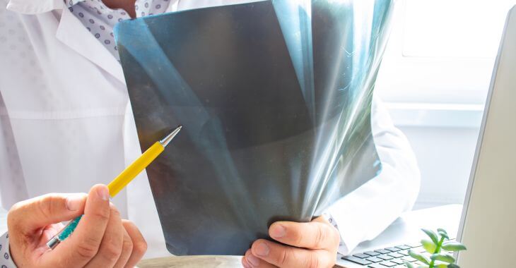 A physician revising X-ray of a broken bone.