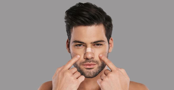 Young man pointing at his nose after saddle nose deformity correction procedure.