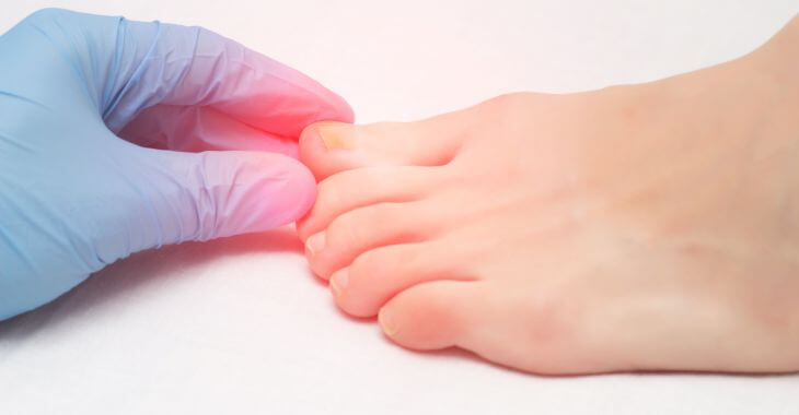 A doctor examining patient's toenails.