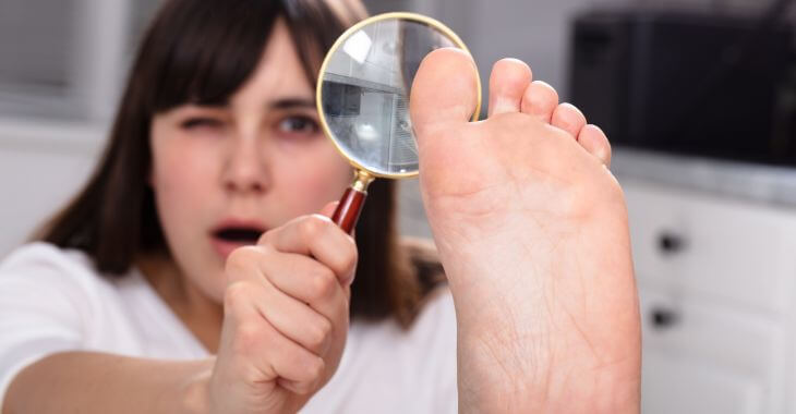 A concerned young woman looking at her toe nails through a magnifying glass.