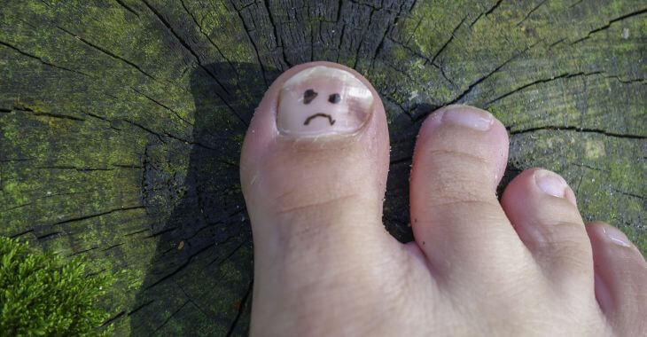 A sad face drawn on a dry toenail