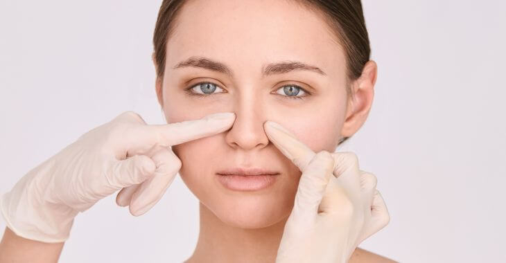 A woman during septoplasty consultation.