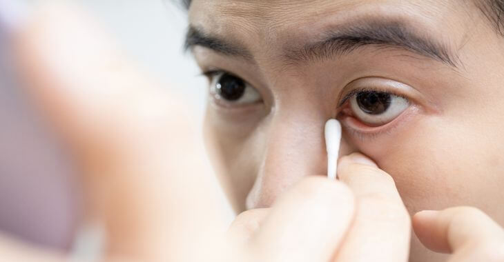 A man using an ear cotton pad to remove an eyelash from the corner of his eye.