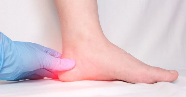 Doctor examining patient's feet and bumps on heels.