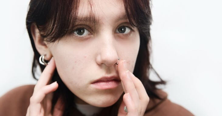 A concerned teenage girl with nose piercing touching the pierced area