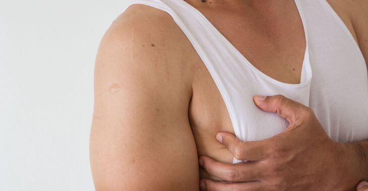 torso of a man with gynecomastia wearing a white sleeveless vest and grabbing his breast