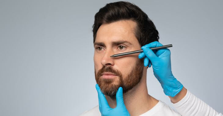 A man during a rhinoplasty consultation and a surgeon making marking on the patient's nose